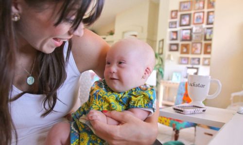 Down Sendromlu Bebeklerin Gelişim Özellikleri Nelerdir?