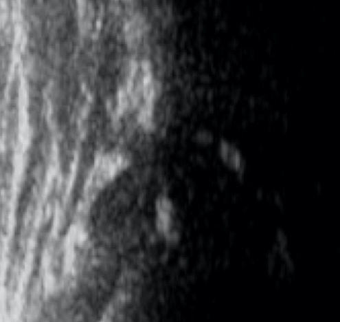 yenidogan-kalca-ultrasonografisi