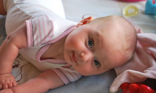 Bebeklerde ve Çocuklarda Göz Kayması Nedenleri ve Tedavisi