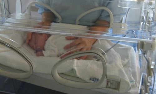 Prematüre Bebeklerde Fizik Tedavi 
