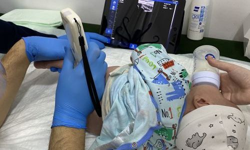 Yenidoğan Kalça Ultrasonu Hakkında Merak Ettikleriniz