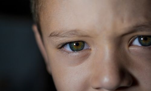 Çocuklarda Göz Tümörü Nedir? Belirtileri Nelerdir?